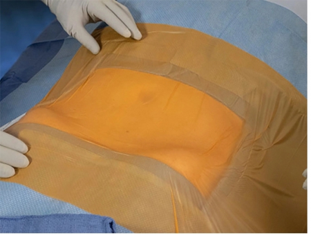 Пленка для инсинерации йодом