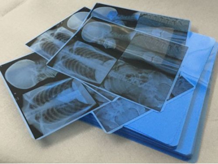 Синяя медицинская пленка для струйной печати  (рентгеновская пленка)